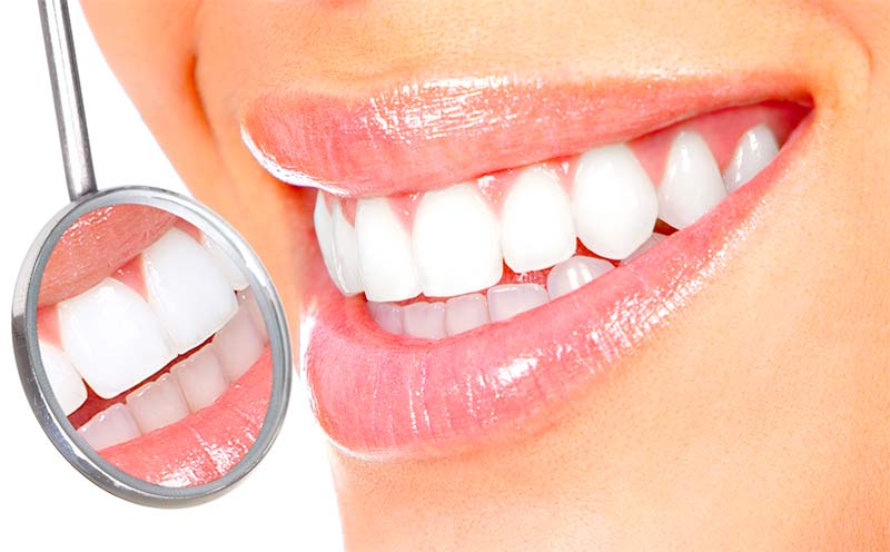 La conservación dental ¿para qué el cemento? - TOP aul@ Salud