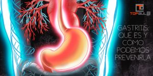 Gastritis: Qué es y cómo podemos prevenirla - www.topaula.com