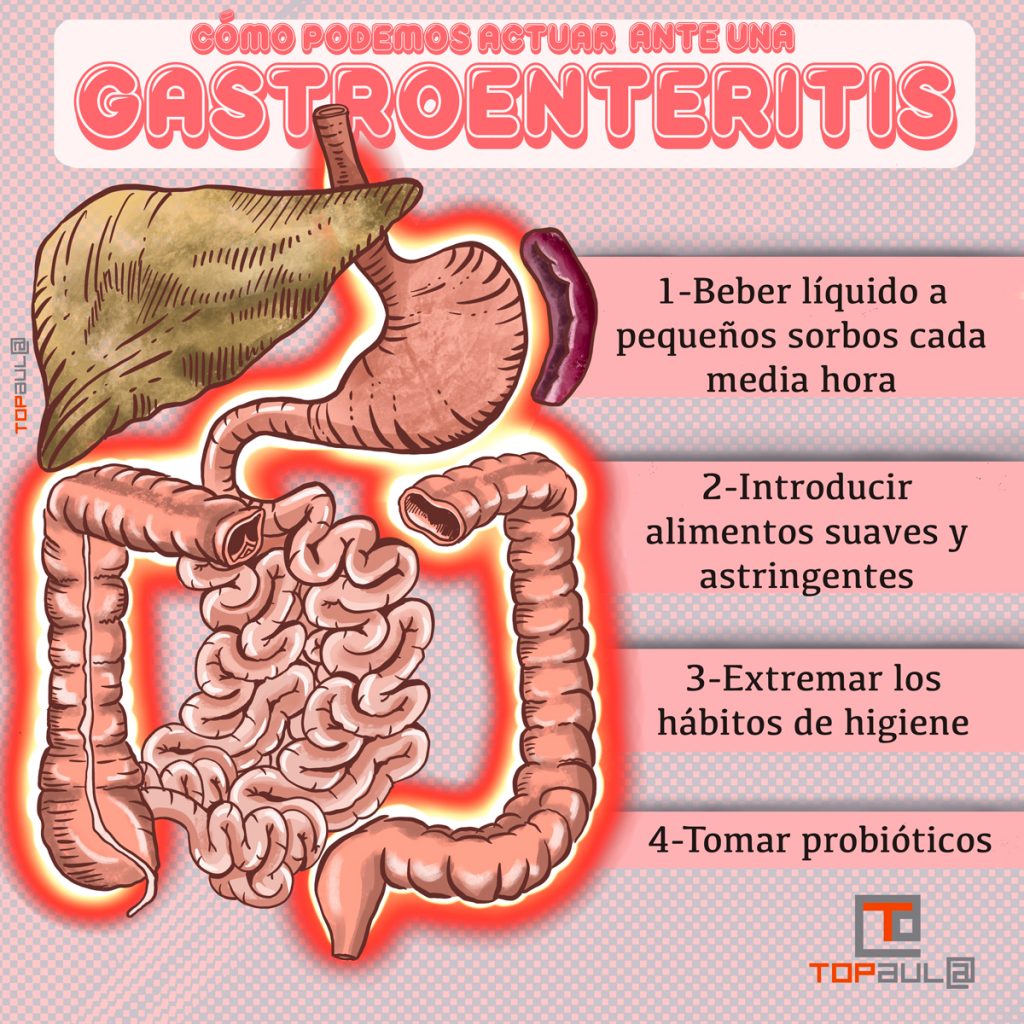 Infografía ¿Cómo podemos actuar ante una gastroenteritis? - www.topaula.com