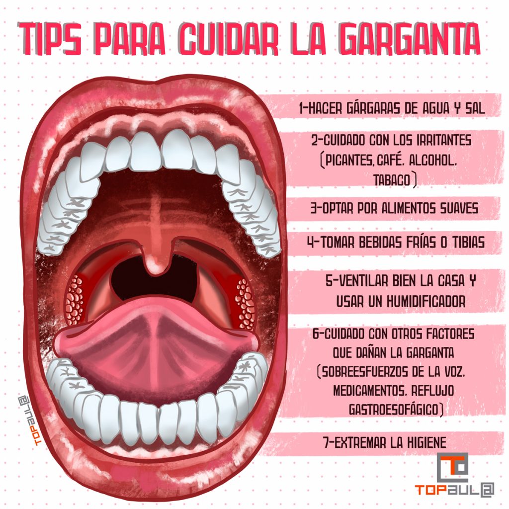 Infografía - Faringitis y amigdalitis: Tips para cuidar la garganta - www.topaula.com